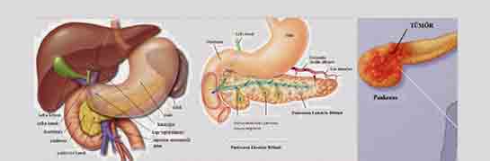Pankreas Şeker Hastalığı